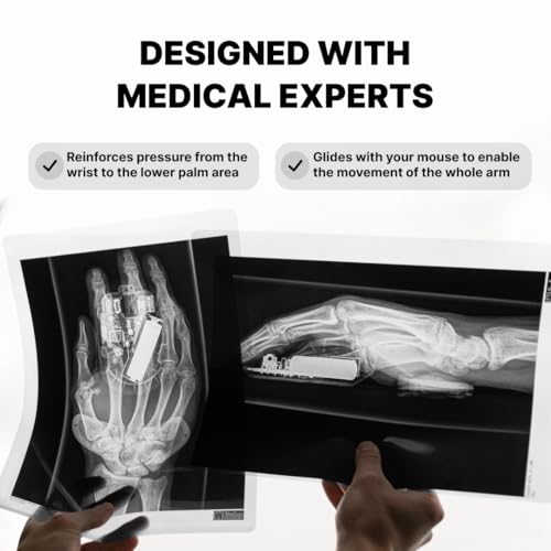 DELTAHUB Carpio 2.0 - Right-Handed Truly Ergonomic Wrist Rest for Mouse, Carpal Tunnel Support, Pain Relief, Anti-Fatigue, Easy Glide, Sleek, Office Computer, Laptop, Gaming - Small, Black