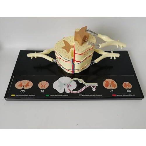 HEQIM Spinal Cord Anatomy Model, Vertebral Column Spinal Cord Model, 5 Times Life-Size - Nerve Branches Spinal Ganglia and Blood Vessels for Teaching