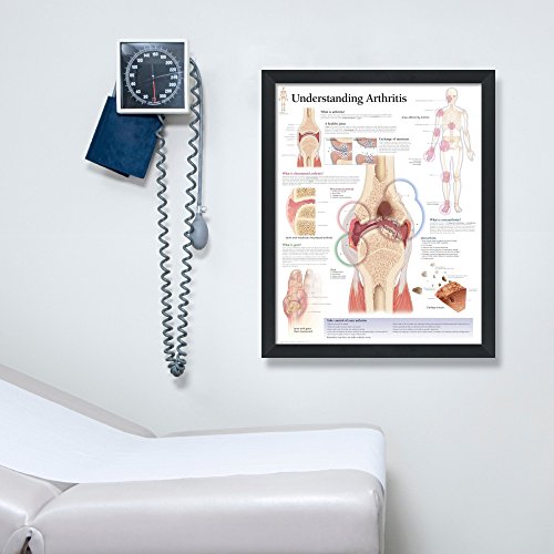 Understanding Arthritis Framed Medical Educational Poster Informational Diagram Doctors Office School Classroom 22x28 Inches