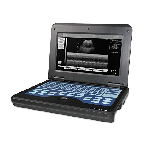 CONTEC CMS600P2 Vet Veterinary,Portable Laptop B-Ultrasound Scanner Machine for Horse/Equine/Sheep Big Animal Use Newest FDA (Convex Probe)