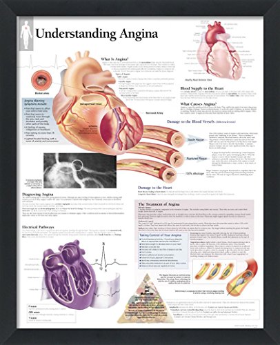 Set of 8 Framed Medical Posters The Heart; Heart Disease; Angina; Vascular; Atrial Fibrillation; Hypertension; High Blood Pressure; ACS 22"x28" Wall Diagrams Educational Doctors Office Charts