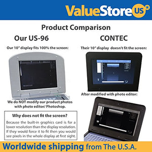 Portable Digital Ultrasound Scanner Veterinary US-96 with Multi-Frequency Convex & Rectal Probe.
