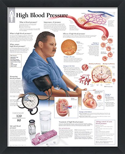Set of 8 Framed Medical Posters The Heart; Heart Disease; Angina; Vascular; Atrial Fibrillation; Hypertension; High Blood Pressure; ACS 22"x28" Wall Diagrams Educational Doctors Office Charts