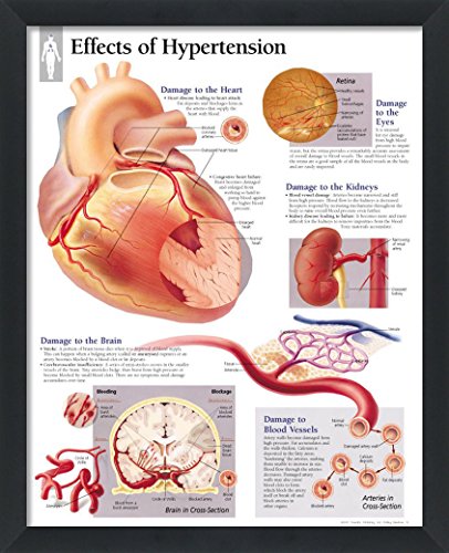 Set of 8 Framed Medical Posters The Heart; Heart Disease; Angina; Vascular; Atrial Fibrillation; Hypertension; High Blood Pressure; ACS 22"x28" Wall Diagrams Educational Doctors Office Charts