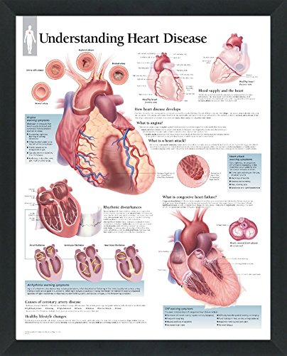 Set of 8 Framed Medical Posters The Heart; Heart Disease; Angina; Vascular; Atrial Fibrillation; Hypertension; High Blood Pressure; ACS 22"x28" Wall Diagrams Educational Doctors Office Charts