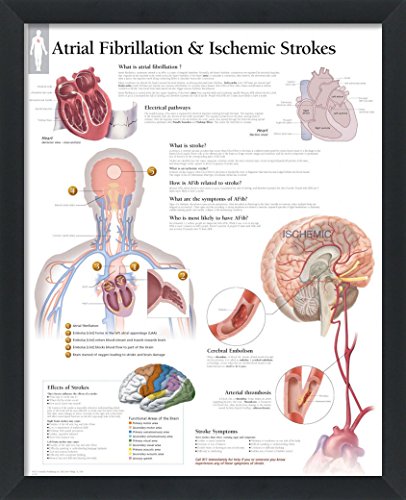 Set of 8 Framed Medical Posters The Heart; Heart Disease; Angina; Vascular; Atrial Fibrillation; Hypertension; High Blood Pressure; ACS 22"x28" Wall Diagrams Educational Doctors Office Charts