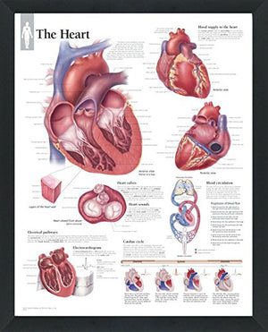 Set of 8 Framed Medical Posters The Heart; Heart Disease; Angina; Vascular; Atrial Fibrillation; Hypertension; High Blood Pressure; ACS 22"x28" Wall Diagrams Educational Doctors Office Charts