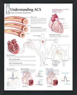 Set of 8 Framed Medical Posters The Heart; Heart Disease; Angina; Vascular; Atrial Fibrillation; Hypertension; High Blood Pressure; ACS 22"x28" Wall Diagrams Educational Doctors Office Charts