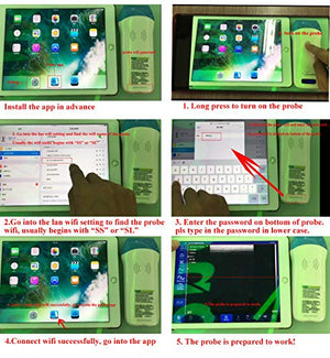 CARESHINE U-l-tras-o-u-d Scanner, Portable WiFi Wireless Scanner with Convex Array Probe 3.5Mhz 80 Elements, Widely Used for iOS and Android Smart Phones, Tablets and Laptops