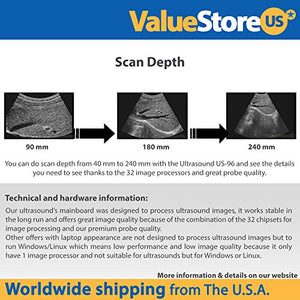 Portable Digital Ultrasound Scanner Veterinary US-96 with Multi-Frequency Convex & Rectal Probe.