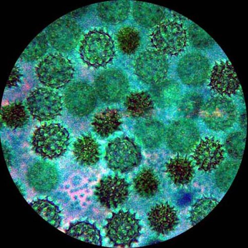 AmScope IN200B-9M Inverted Tissue Culture Microscope 40X-800X + 9M Camera
